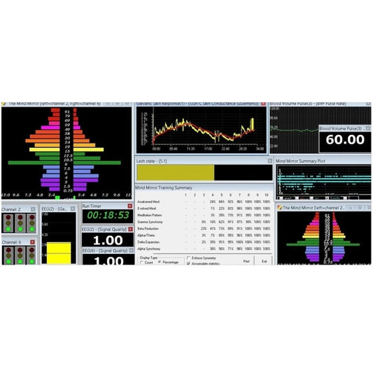 Additional Mind Mirror Software License
