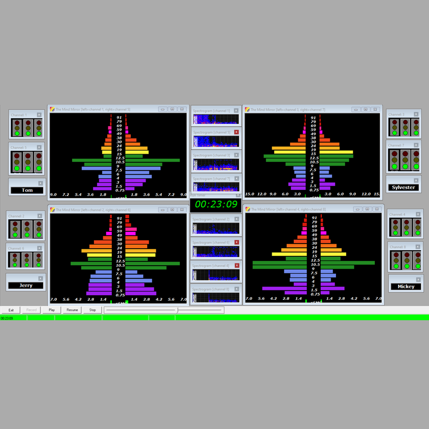 Practitioner Kit with 4 EEG sensors